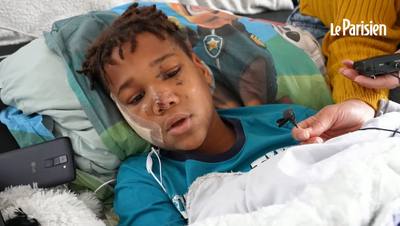 Attaqué par un chien, un adolescent de 11 ans raconte son agression